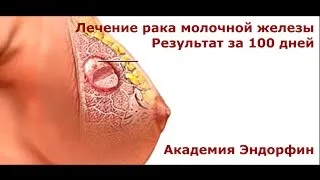 Чорні круги під очима
