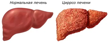 Що таке печінковий метаболізм - це повинен знати кожен (метаболізм) Що таке печінковий метаболізм - це повинен знати кожен
