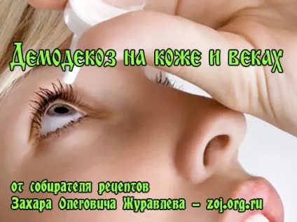 Демодекоз особи у людини - поради по лікуванню, лікування в домашніх умовах (лікування) Демодекоз особи у людини - поради по лікуванню, лікування в домашніх умовах