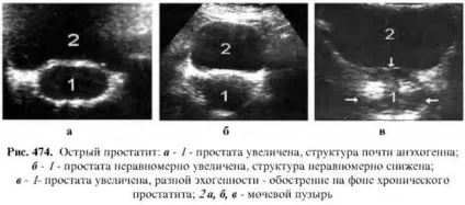 Діагностика захворювань простати (захворювань) Діагностика захворювань простати