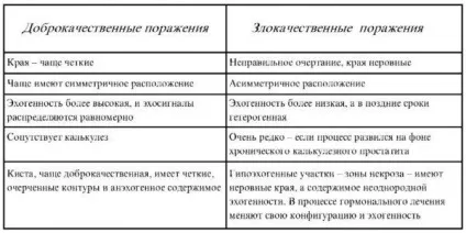 Діагностика захворювань простати (більш високої ехогенності) Діагностика захворювань простати