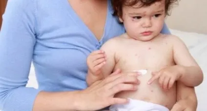 Дієта у дітей при вітрянці харчування при вітряної віспи, яку їжу можна їсти (дітей) Дієта у дітей при вітрянці харчування при вітряної віспи, яку їжу можна їсти
