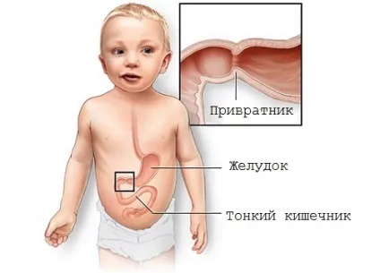 Ентерит у дітей характерні симптоми і необхідну лікування