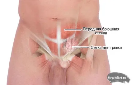 Гіпертонія жовчного міхура симптоми лікування чому не діють ліки від високого тиску (можна при гіпертонії пити каву) Гіпертонія жовчного міхура симптоми лікування чому не діють ліки від високого тиску