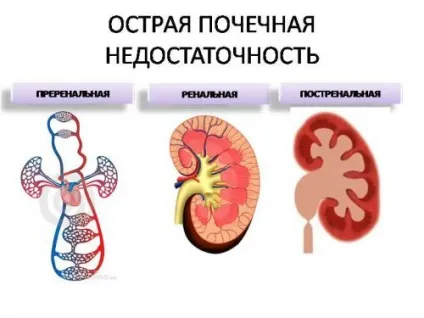 Головні функції нирок в організмі людини, їх взаємозв'язок з будовою органу (організмі) Головні функції нирок в організмі людини, їх взаємозв'язок з будовою органу