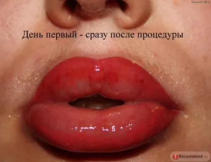 Губи після татуажу як вони виглядають на 2-й і 3-й день, фото і відео (татуажу) Губи після татуажу як вони виглядають на 2-й і 3-й день, фото і відео