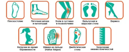 Індивідуальні ортопедичні устілки на замовлення - ортопедичні устілки в Харкові в (виготовлення устілок) Індивідуальні ортопедичні устілки на замовлення - ортопедичні устілки в Харкові в