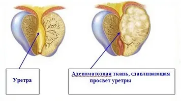 Шукаєте де зробити УЗД простати (проблем передміхурової залозою) Шукаєте де зробити УЗД простати