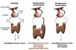Їх функції гіпофіза і щитовидної залози лікування в домашніх умовах (гіпофіза щитовидної залози) Їх функції гіпофіза і щитовидної залози лікування в домашніх умовах