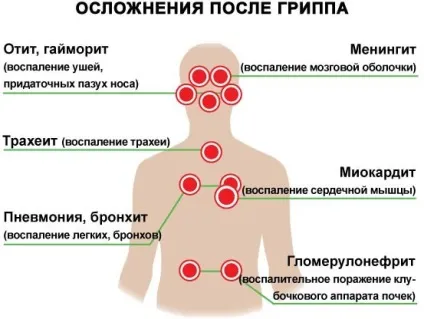 Як швидко підвищити імунітет після грипу всі способи і засоби (кошти) Як швидко підвищити імунітет після грипу всі способи і засоби