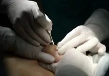 Види грудних імплантів – матеріали, розміри, розташування – портал «Естетична медицина» – ціна, види