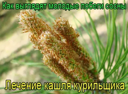 Як лікувати кашель курця - методики з особистого досвіду, лікування в домашніх умовах (лікувати) Як лікувати кашель курця - методики з особистого досвіду, лікування в домашніх умовах