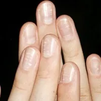 Як визначити здоров'я людини по нігтям (нігтям) Як визначити здоров'я людини по нігтям