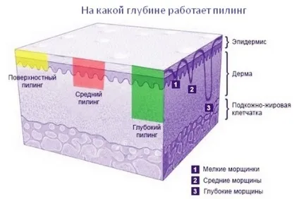 Який пілінг для обличчя краще для омолодження та усунення дефектів
