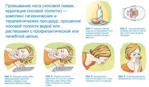 Як застосовувати диоксидин при нежиті