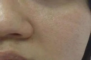 Як приховати розширені пори за допомогою макіяжу і правильного догляду (макіяжу) Як приховати розширені пори за допомогою макіяжу і правильного догляду