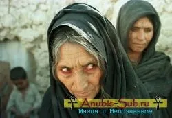 Як дізнатися, чи є пристріт - 4 способи визначення