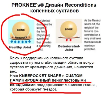 Як вибрати будівельні наколінники (наколінники) Як вибрати будівельні наколінники