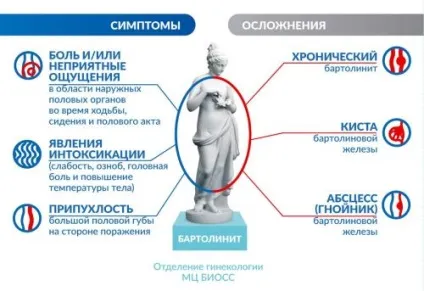 Кіста бартолінової залози, лікування без операції, народними засобами (маззю) Кіста бартолінової залози, лікування без операції, народними засобами