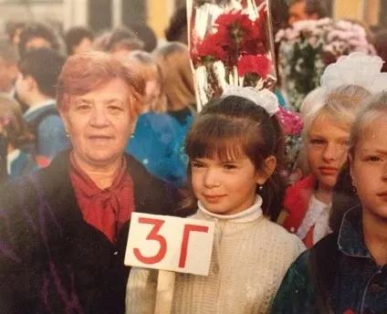 Катя жужа фото до і після пластики - 300 (пластики) Катя жужа фото до і після пластики - 300