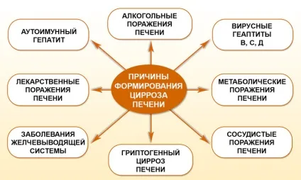 Цироз печінки - це рак чи ні
