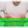 Дієтичне харчування при дуоденіт особливості та рекомендації (дуоденіт) Дієтичне харчування при дуоденіт особливості та рекомендації