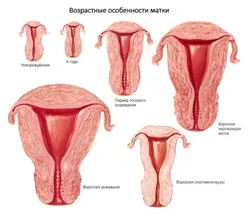 Маленька матка що це таке
