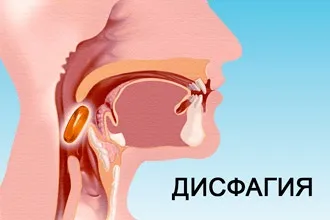 Їжа застряє в горлі - що робити, якщо шматочок їжі погано проходить і стоїть (погано) Їжа застряє в горлі - що робити, якщо шматочок їжі погано проходить і варто