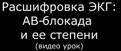 ЕКГ при ав-блокаді (атріовентрикулярній блокаді) - діагностика, лікування