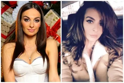 Катерина Варнава хвороба або наслідки пластики (Катерина Варнава після) Катерина Варнава хвороба або наслідки пластики