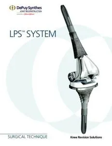 Ендопротез depuy - традиційне якість і інноваційний підхід (ендопротез) Ендопротез depuy - традиційне якість і інноваційний підхід