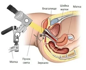 Ендоскопічні методи дослідження в гінекології, medical books 24 (дослідження) Ендоскопічні методи дослідження в гінекології, medical books 24