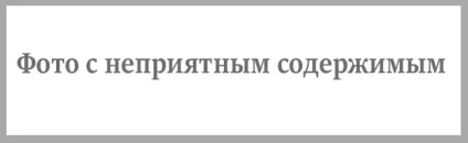 Екзема на руках фото, причини, стадії, ніж лікувати (лікувати) Екзема на руках фото, причини, стадії, ніж лікувати