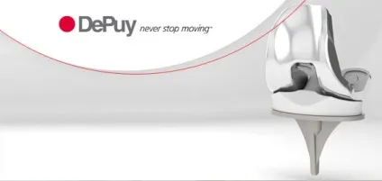 Ендопротез depuy - традиційне якість і інноваційний підхід (підхід) Ендопротез depuy - традиційне якість і інноваційний підхід