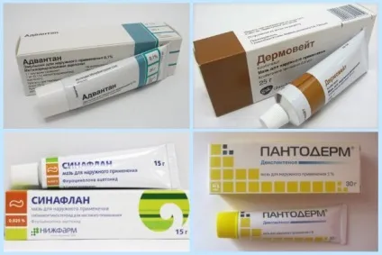 Екзематозний дерматит, атопічна екзема лікування маззю