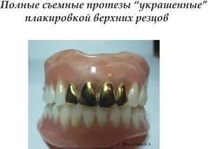Естетика в стоматології - Полтаваскій стоматологічний портал (волгоградський) Естетика в стоматології - Полтаваскій стоматологічний портал