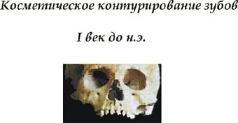 Естетика в стоматології - Полтаваскій стоматологічний портал (зуби) Естетика в стоматології - Полтаваскій стоматологічний портал