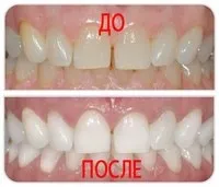Ех, спробувала відбілити