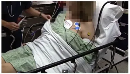 Фібриляція шлуночків 1