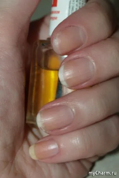 Масло буквально перетворило мої нігті - eveline cosmetics eveline поживне масло для нігтів і (eveline) Масло буквально перетворило мої нігті - eveline cosmetics eveline поживне масло для нігтів і