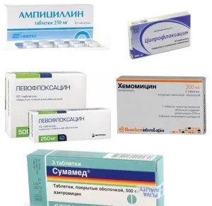 Гайморит, симптоми і лікування у дорослих різними методами (методами) Гайморит, симптоми і лікування у дорослих різними методами