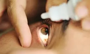 Герпетичний кератит лікування, поверхневий кератит (поверхневий кератит) Герпетичний кератит лікування, поверхневий кератит