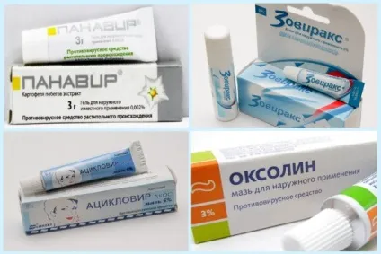 Герпес на губах, лікування швидко як вилікувати за 1 день (день) Герпес на губах, лікування швидко як вилікувати за 1 день