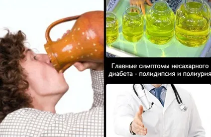 Гіперфункція і гіпофункція гіпофіза у дорослих як розвивається і проявляється (дорослих) Гіперфункція і гіпофункція гіпофіза у дорослих як розвивається і проявляється