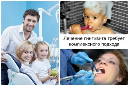 Гіпертрофічний гінгівіт - діагностика і лікування рідкісної хвороби (стають дуже чутливими) Гіпертрофічний гінгівіт - діагностика і лікування рідкісної хвороби