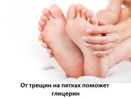 Гліцерин від тріщин на п'ятах, сайт про методи лікування докторів Неумивакіна, Болотова, огулова (гліцерин) Гліцерин від тріщин на п'ятах, сайт про методи лікування докторів Неумивакіна, Болотова, огулова