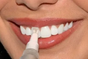 Hollywood smile в нашому огляді відбілюючий олівець (smile) Hollywood smile в нашому огляді відбілюючий олівець