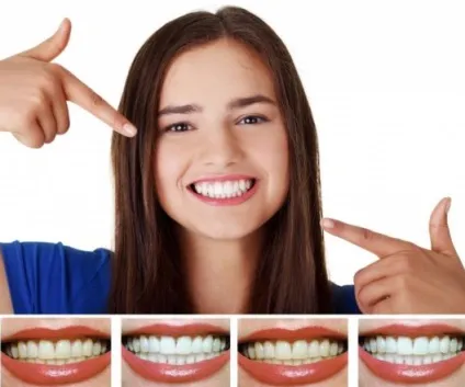 Hollywood smile в нашому огляді відбілюючий олівець (smile) Hollywood smile в нашому огляді відбілюючий олівець