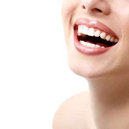 Hollywood smile