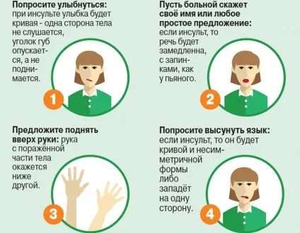 Інсульт ішемічний, ліва сторона (лівостороннього ішемічного інсульту) Інсульт ішемічний, ліва сторона